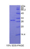 Rat Recombinant Galactosidase Beta (GLb)