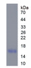 Mouse Recombinant Fatty Acid Binding Protein 9, Testis (FABP9)