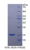 Human Recombinant Caveolin 1 (CAV1)