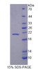 Cattle Recombinant Interleukin 1 Receptor Antagonist (IL1RA)