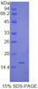 Human Recombinant Immunoglobulin G4 (IgG4)