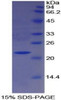 Human Recombinant Paraoxonase 1 (PON1)