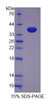 Human Recombinant Transferrin Receptor 2 (TFR2)