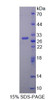 Mouse Recombinant Transferrin Receptor 2 (TFR2)