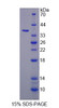 Rat Recombinant Transferrin Receptor 2 (TFR2)