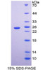 Human Recombinant Linker For Activation Of T-Cell (LAT)