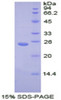 Human Recombinant Transportin 1 (TNPO1)