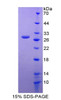 Human Recombinant Inhibin Binding Protein (INHBP)