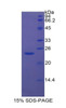 Rat Recombinant Insulin Like Growth Factor Binding Protein 6 (IGFBP6)