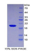 Human Recombinant Centromere Protein E (CENPE)