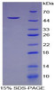 Human Recombinant Prostaglandin E Receptor 3 (EP3)