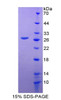 Mouse Recombinant Glutamate Dehydrogenase 1 (GDH)