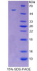 Rabbit Recombinant Galectin 3 (GAL3)