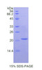 Rat Recombinant Cathepsin L (CTSL)