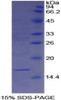 Human Recombinant Galectin 7 (GAL7)