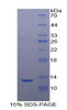 Human Recombinant Urotensin 2 (UST2)