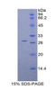 Rat Recombinant Retinol Binding Protein 3, Interstitial (RBP3)