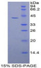 Human Recombinant Gelsolin (GS)