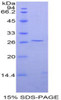 Rat Recombinant GATA Binding Protein 4 (GATA4)