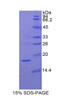 Pig Recombinant Retinol Binding Protein 2, Cellular (RBP2)