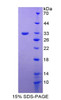 Human Recombinant Follistatin (FS)