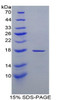 Human Recombinant Retinol Binding Protein 1, Cellular (RBP1)