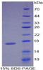 Rat Recombinant Retinol Binding Protein 1, Cellular (RBP1)