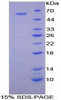 Human Recombinant Cadherin, Retinal (RCAD)