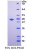 Human Recombinant Elastin Microfibril Interface Located Protein 1 (EMILIN1)