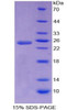 Human Recombinant Apobec 1 Complementation Factor (ACF)