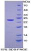 Human Recombinant Caspase 7 (CASP7)