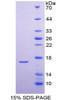 Human Recombinant Parathyroid Hormone Receptor 2 (PTHR2)