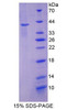 Mouse Recombinant Keratin 2 (KRT2)