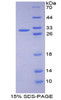 Human Recombinant Protein Kinase D1 (PKD1)