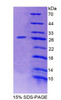 Mouse Recombinant Protein Kinase D2 (PKD2)