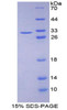 Mouse Recombinant Ataxin 1 (ATXN1)