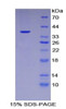 Human Recombinant Keratin 15 (KRT15)