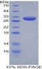 Rabbit Recombinant Apolipoprotein A1 (APOA1)