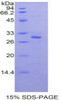 Rat Recombinant Protein Kinase R (PKR)