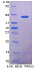 Rat Recombinant Keratin 14 (KRT14)