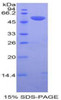 Human Recombinant Plasminogen Activator, Tissue (tPA)