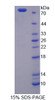 Pig Recombinant Plasminogen Activator, Tissue (tPA)