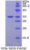 Rat Recombinant Plasminogen Activator Inhibitor 2 (PAI2)