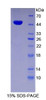 Human Recombinant Enolase, Neuron Specific (NSE)