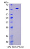 Mouse Recombinant Enolase, Neuron Specific (NSE)