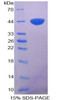 Chicken Recombinant S100 Calcium Binding Protein A11 (S100A11)