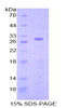 Human Recombinant Selectin, Platelet (SELP)