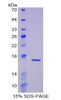 Rat Recombinant Laminin Alpha 1 (LAMa1)