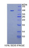 Human Recombinant Aquaporin 2, Collecting Duct (AQP2)