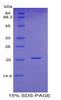 Human Recombinant Fibrillin 1 (FBN1)